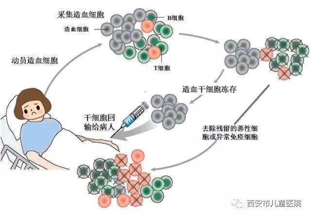 长期的中度饮食限制可使老年小鼠的造血干细胞恢复活力,提高总骨髓的