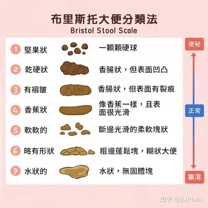 大便哪种状态表示身体最健康