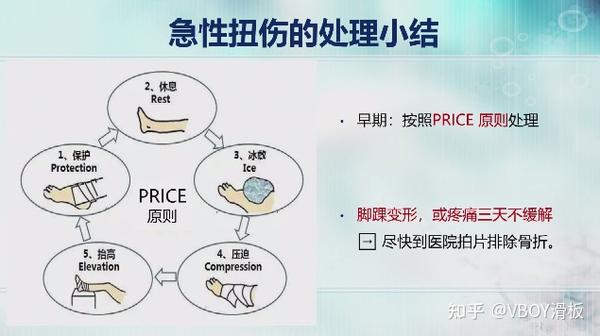 如果在滑板时出现了崴脚的情况,在处理时我们要遵循price原则,按照