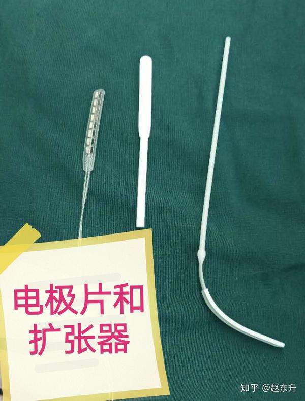 昏迷病人苏醒的新希望——脊髓电刺激疗法