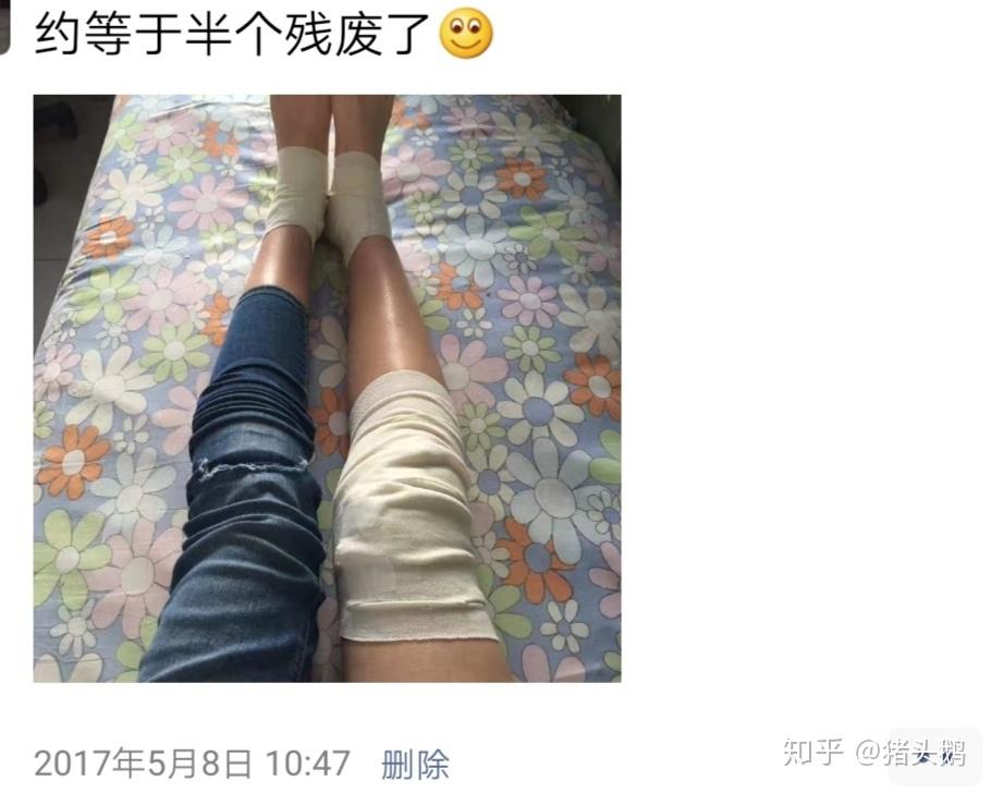 记腿残多年的经历