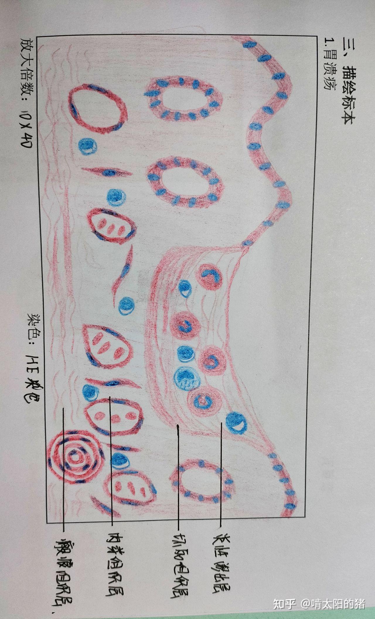 病理切片红蓝铅笔手绘图