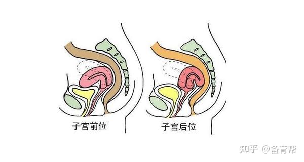 子宫前位和后位,哪个更容易怀孕?很多女生都搞错了