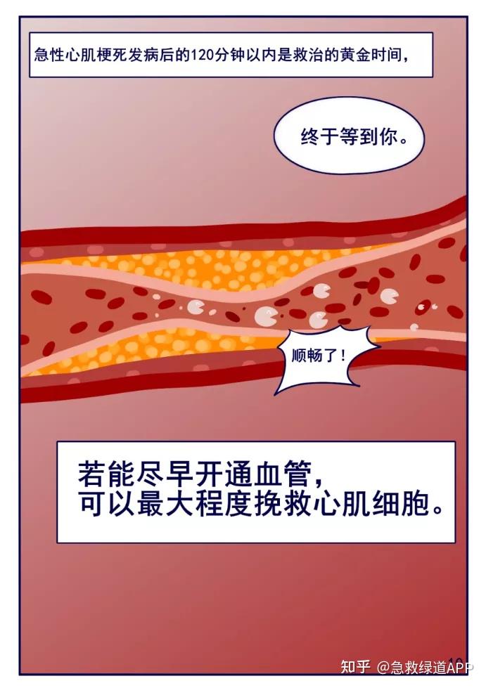 心梗系列漫画4急性心肌梗死的救治方法溶栓还是支架