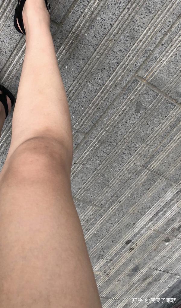 晒晒我朋友的腿,当初就是被她这效果图吸引了.