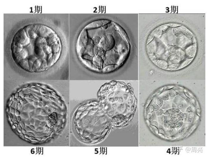 试管科普什么是优质胚胎试管婴儿的胚胎分级你必须知道