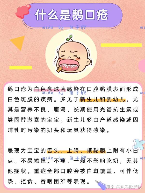 心疼宝宝得了鹅口疮只因妈妈犯了这个错