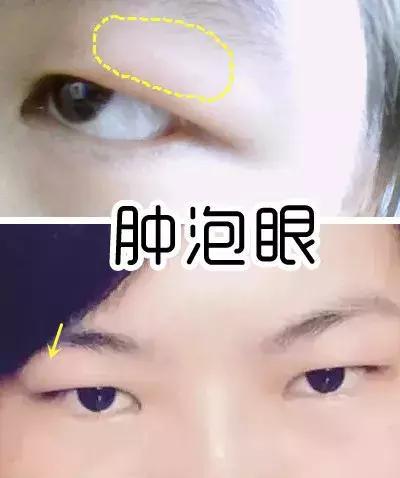 毛晓彤的眼睛缩了一半?这次是真的认不出了!