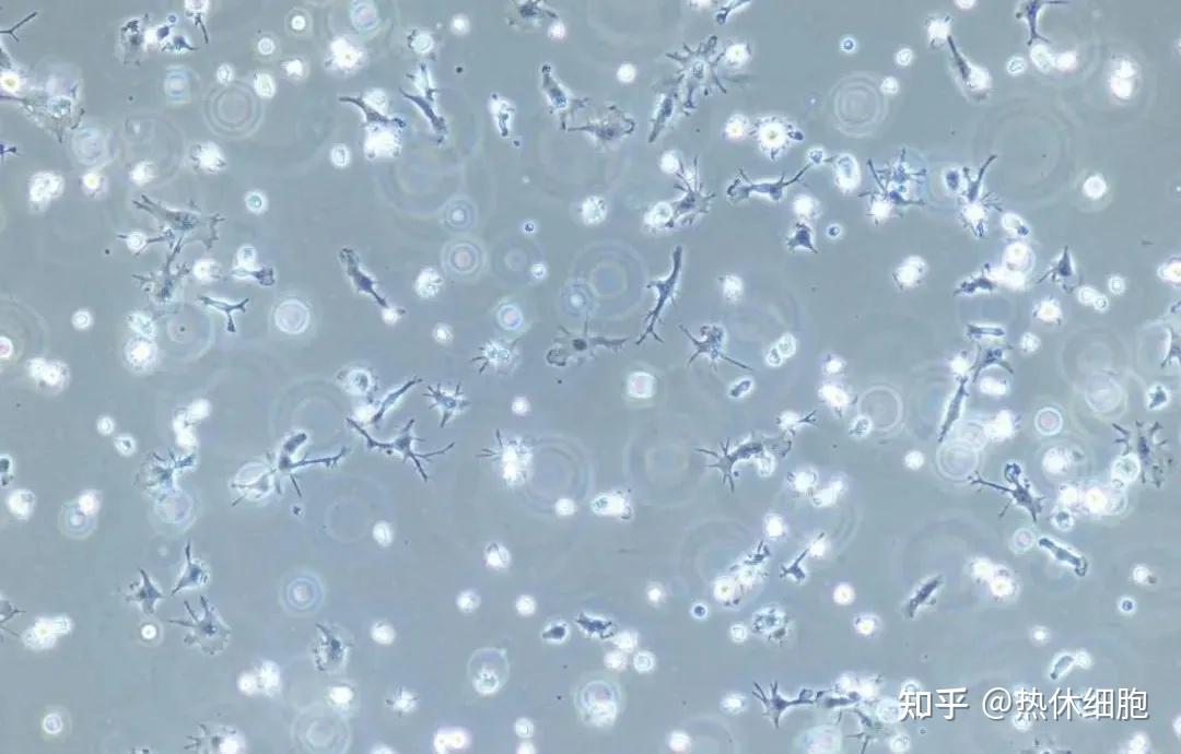 dc细胞肿瘤疫苗攻克癌症的新希望