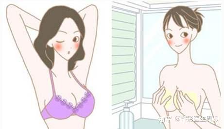 目前隆胸修复包括假体隆胸修复,自体脂肪隆胸修复,奥美定隆胸修复