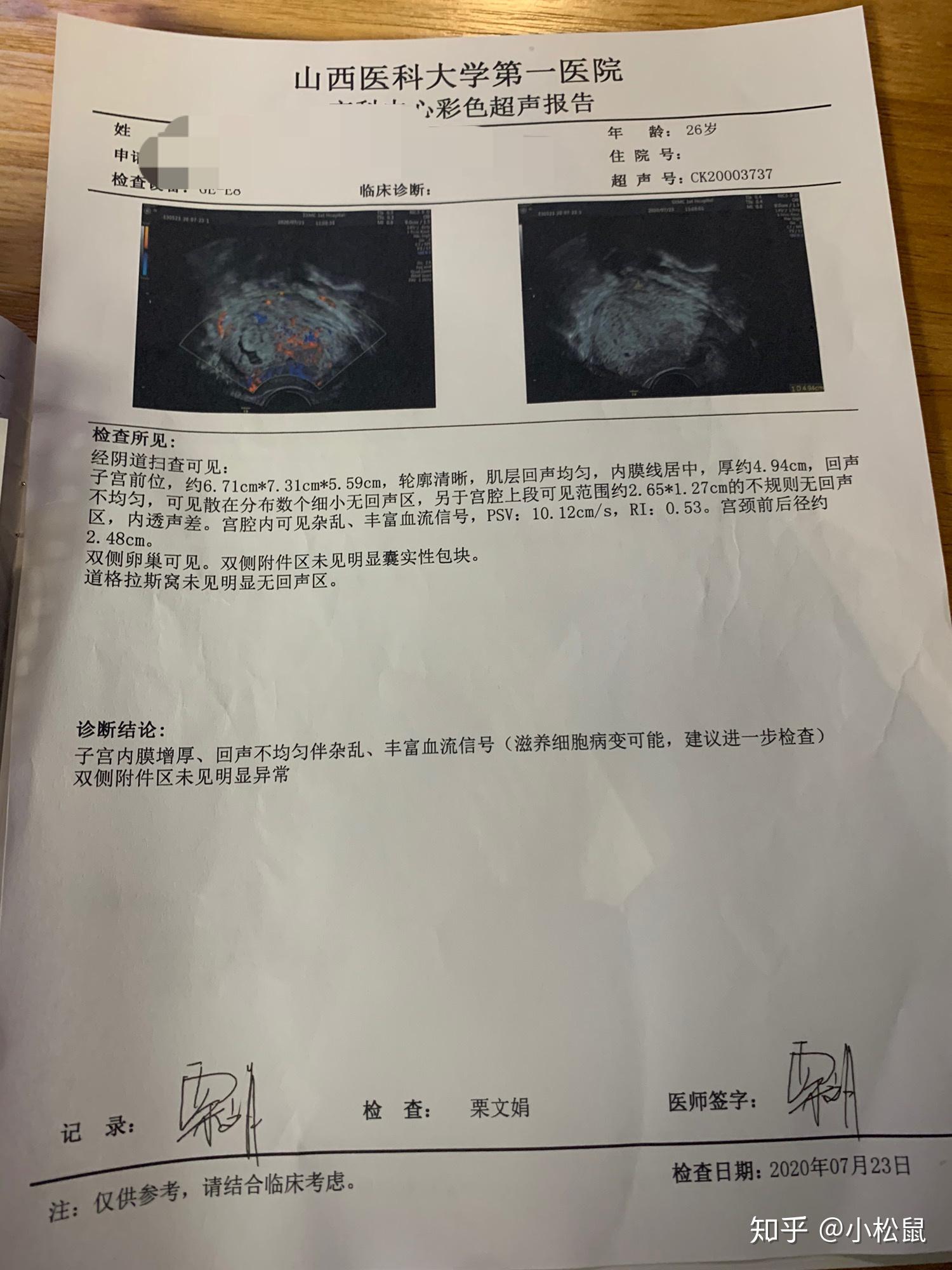 找不到孕囊,给b超医生看了早上的b超单,问她是不是葡萄胎,四维彩超