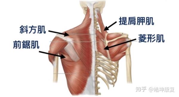 肩膀抬不起来肩峰撞击综合症