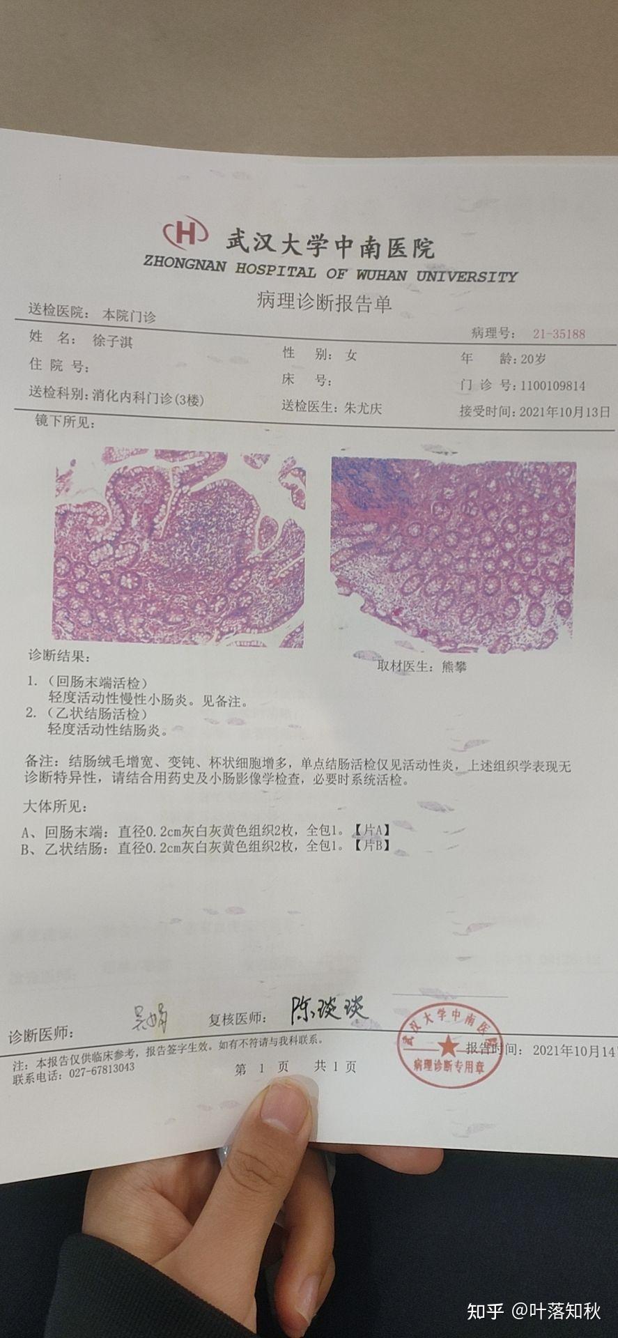 年轻人得小肠癌的概率大吗做过胃肠镜但小肠那断断续续有咕噜声也偶尔