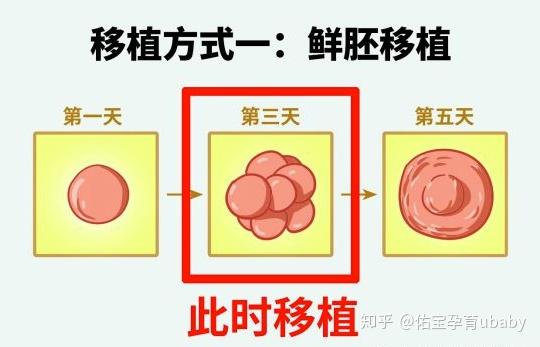 科普胚胎移植种类多我来帮你拨云见日