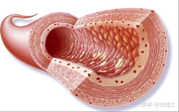 克罗恩病(crohn"s disease cd) 是一种消化道的慢性,反复发作的炎症