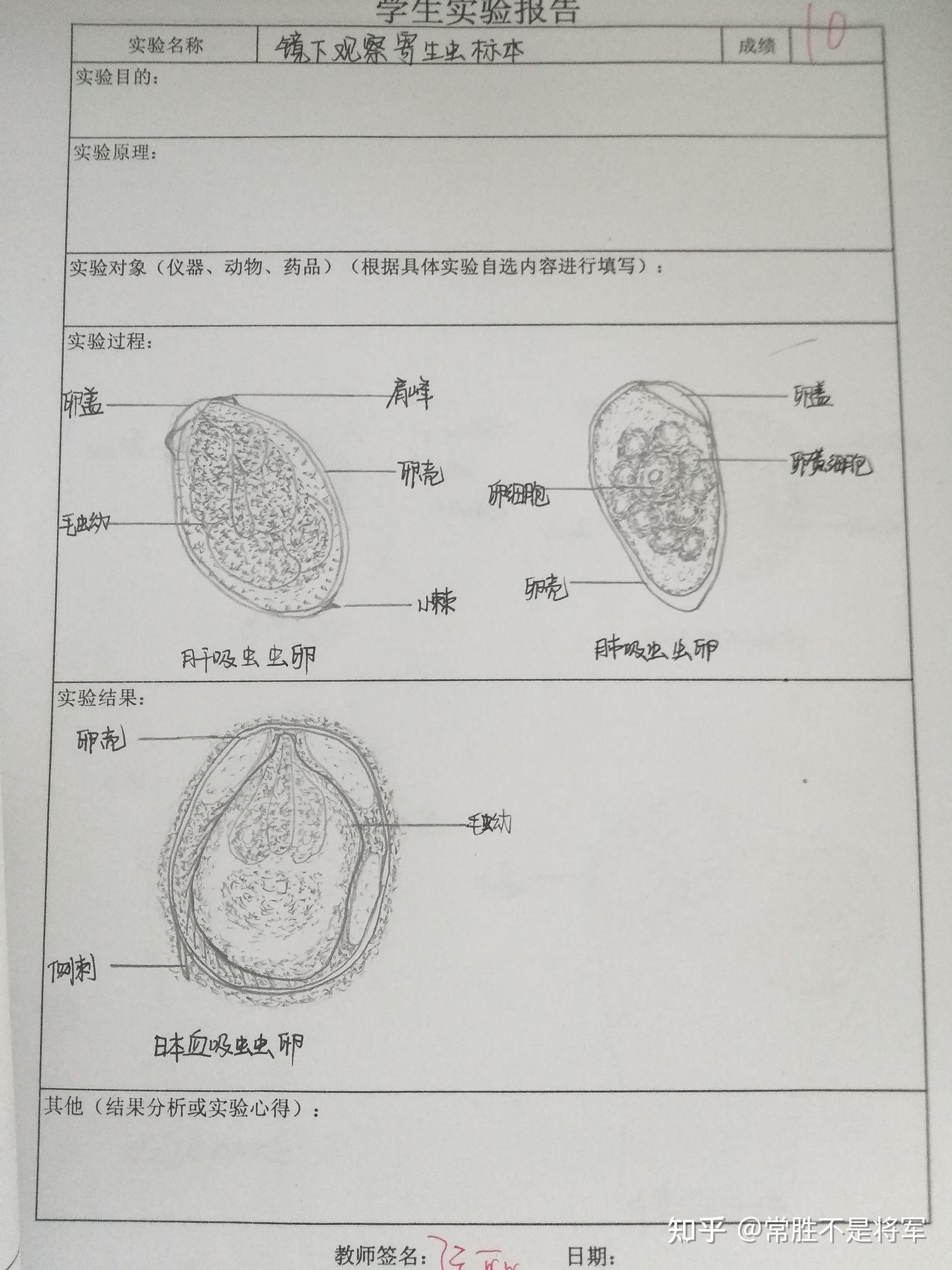 分享一波寄生虫标本手绘