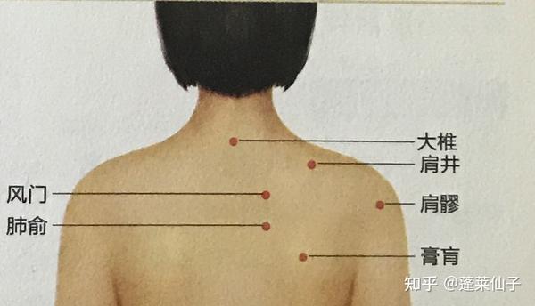 刮痧拔罐治咳嗽