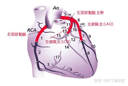 右侧为右后降支)和左回旋支是左冠状动脉主干下的两个主分支