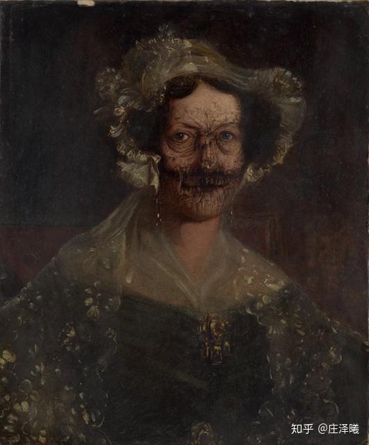 世界上最令人恶心的绘画是医学插图,因为上面画着的东西在现实世界中