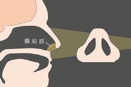 首大崔付军:鼻前庭发炎有哪些并发症 需尽早治疗