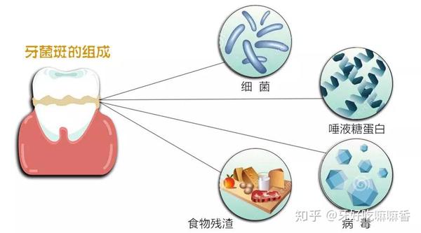 牙菌斑中的细菌们安居乐业,不担心被冲走,然后就开始对它所黏附的牙齿