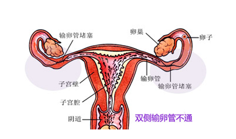 子宫内膜是影响胚胎着床成功与否的重要关键之一
