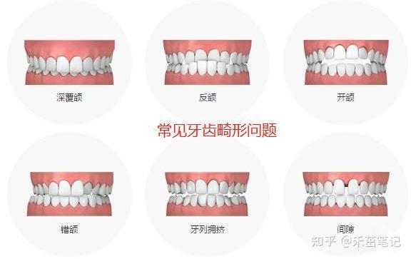 9 赞同 · 1 评论文章关于很多人比较关心的牙齿矫正费用问题,也可以