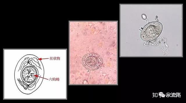 带绦虫卵血吸虫卵姜片虫卵肺吸虫卵肝吸虫卵蛲虫卵鞭虫卵钩虫卵未受精