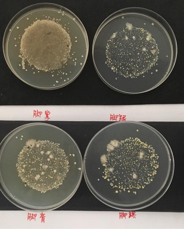 造成脚气的真菌,如果放在培养皿上培养,会变成蘑菇或肉眼可见的东西吗