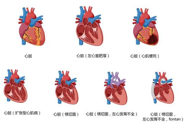 心血管系统高清矢量图汇总,心内科医生必备