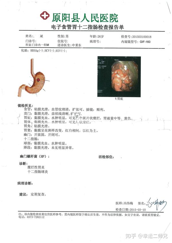 后来回老家后,又去县医院做了第二次胃镜:结果是糜烂性胃炎和十二指肠