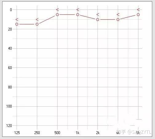 一张右耳的正常听力图
