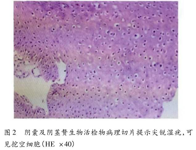 如何看待 hpv 疫苗之父建议男性也接种 hpv 疫苗?有