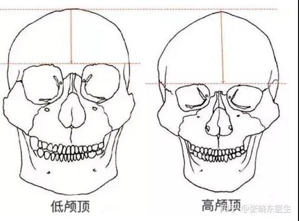 颅顶低就是颜值的bug?从现在的主流审美来看,确实是.