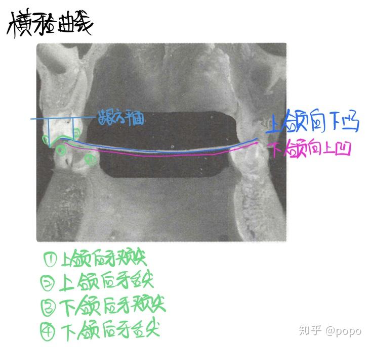 连接双侧同名磨牙颊,舌尖,可形成一条凸向下的曲线—上颌的横牙合曲线