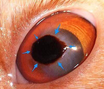 发病原因: 遗传性问题,病毒性原因,眼睛结构异常长期慢性刺激导致角膜