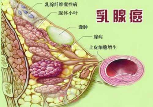 局部治疗包括手术切除,放射治疗,是直接针对肿瘤及其周围组织的治疗