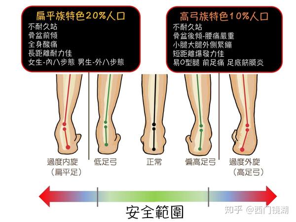 高足弓的人,比较容易出现足内翻,低足弓就是扁平足,比较容易出现足