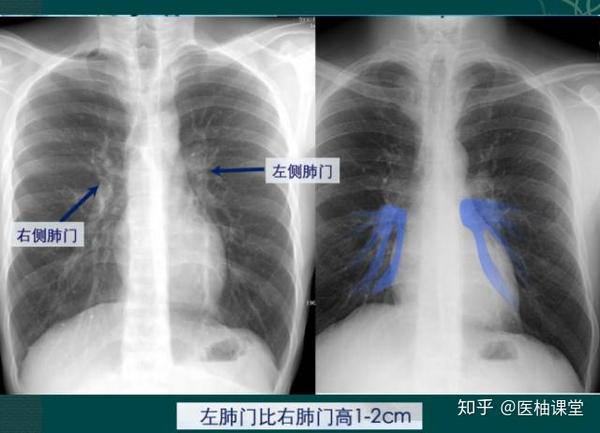 心影位置及大小