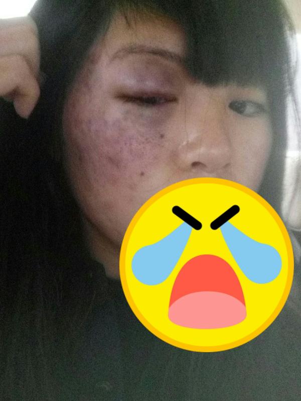 脸上有胎记是一种怎样的体验?