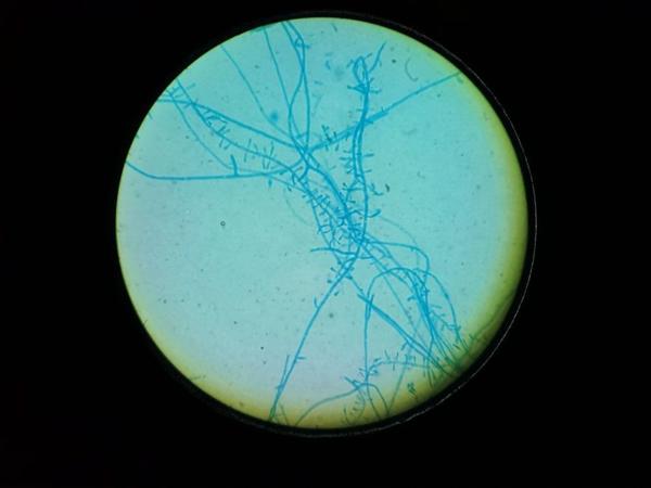 【真菌镜检下红色毛癣菌】