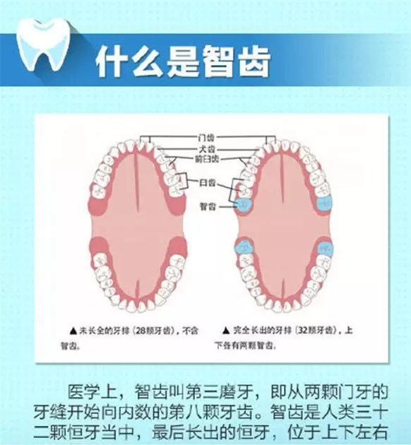 智齿(尽头牙)要拔吗?看看你就知道了