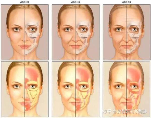 打除皱针后眼袋好重法令纹明显为什么呢