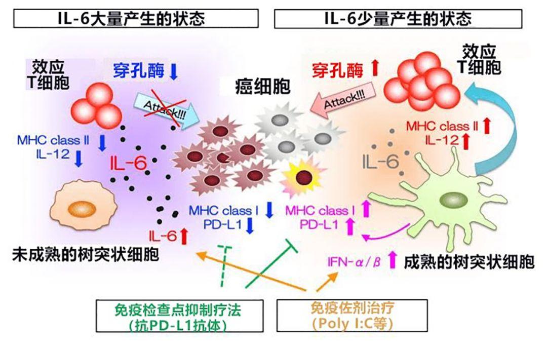 日本查清促进大肠癌肝转移新控制机制阻断il6信号有望抑制转移