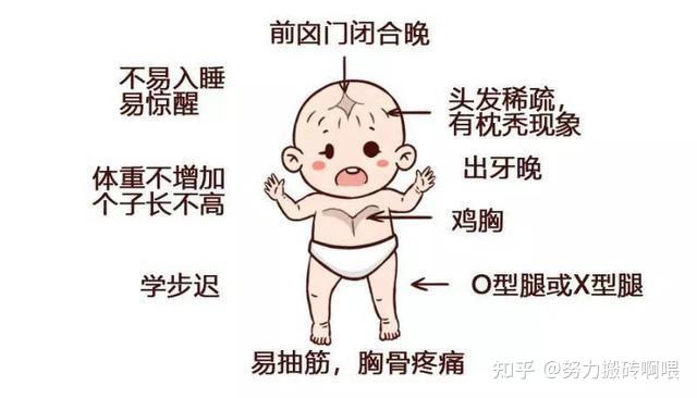 如果宝宝的体内缺乏维生素d,会间接地导致孩子缺钙,出现缺钙的一系列