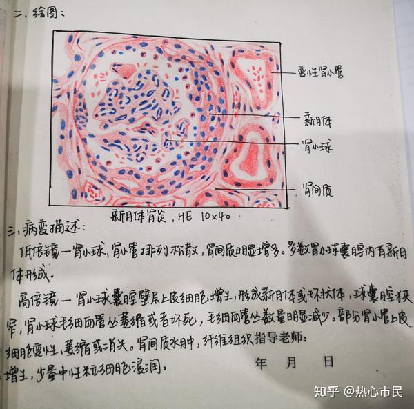 病理学红蓝铅笔手绘图实验报告病变描述