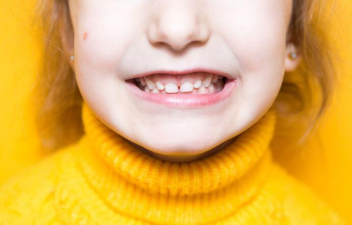 上海圣贝口腔提醒:家长注意|孩子在12岁前须处理的20种牙颌畸形