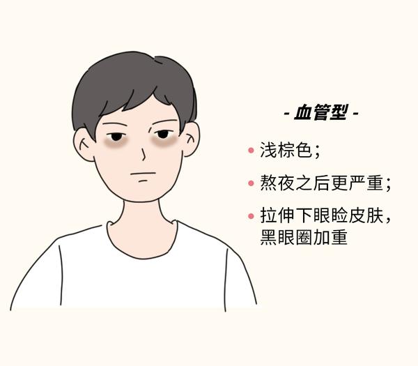 想要拥有一双迷人双眼?从了解黑眼圈开始