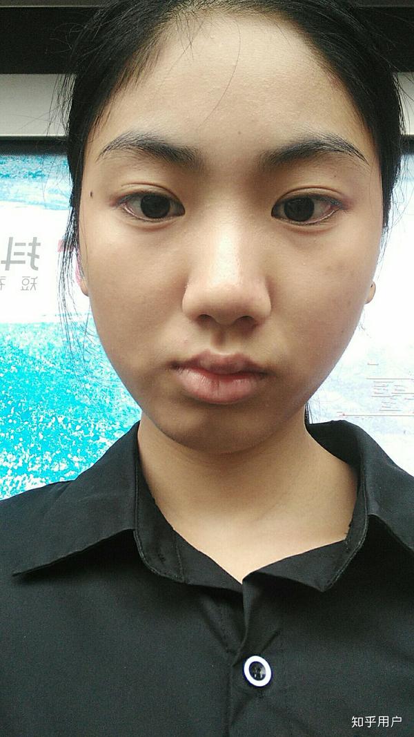 鼻子丑毁了整张脸是什么体验?