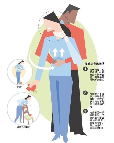 海姆立克急救法之成人篇